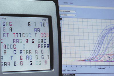 pathologie tübingen