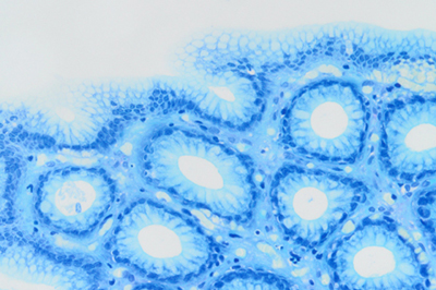 pathologie tübingen